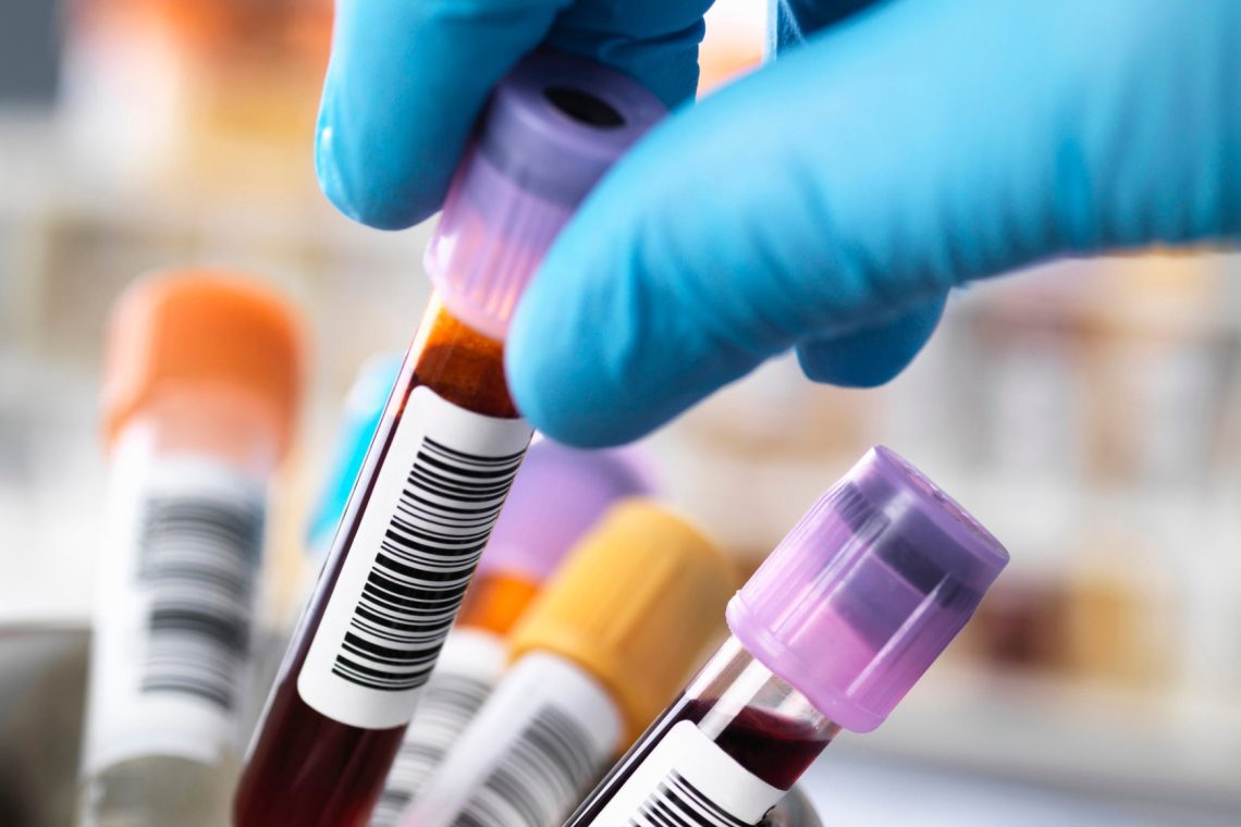 Na infekcijski kliniki v Ljubljani povečano število bolnikov